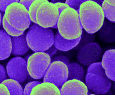 Welcome to meningitis.com