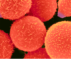 Welcome to meningitis.com